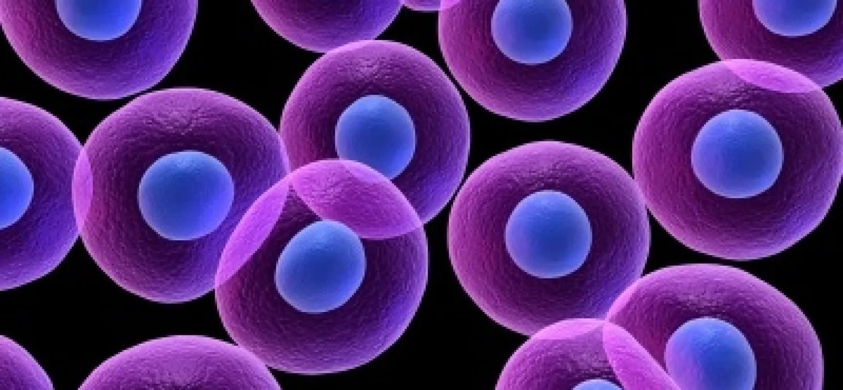 {'en': 'Study is proposed to treat diabetes with umbilical cord stem cells', 'es': 'Estudio se propone tratar la diabetes con células madre del cordón umbilical'} Image {'en': 'Study is proposed to treat diabetes with umbilical cord stem cells', 'es': 'Estudio se propone tratar la diabetes con células madre del cordón umbilical'} Image