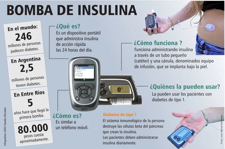 {'en': 'The insulin bomb changes the life of people with diabetes (Argentina)', 'es': 'La bomba de insulina cambia la vida a personas con diabetes (Argentina)'} Image {'en': 'The insulin bomb changes the life of people with diabetes (Argentina)', 'es': 'La bomba de insulina cambia la vida a personas con diabetes (Argentina)'} Image