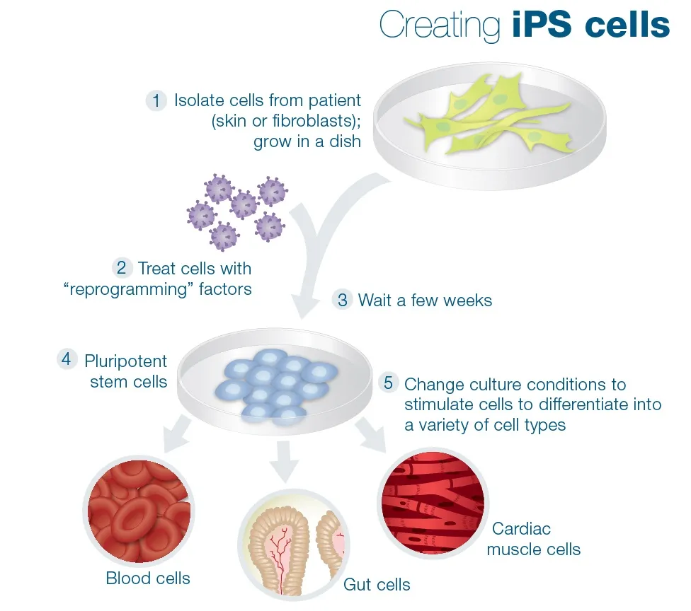 {'en': 'Cell transplant with new IPS technique, possible cure for type 1 diabetes?', 'es': 'Trasplante de células con nueva técnica IPS ¿Posible cura para la diabetes tipo 1?'} Image {'en': 'Cell transplant with new IPS technique, possible cure for type 1 diabetes?', 'es': 'Trasplante de células con nueva técnica IPS ¿Posible cura para la diabetes tipo 1?'} Image