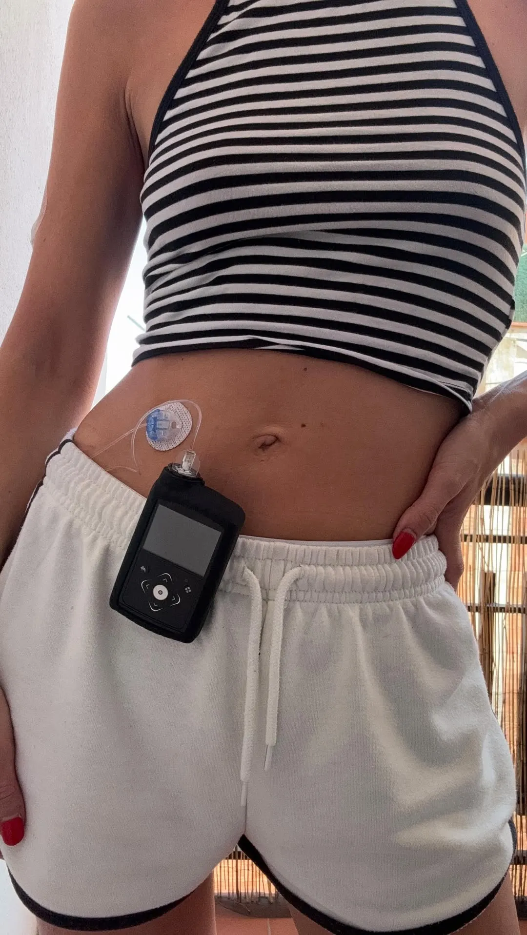 {'en': 'Ares Teixidó: When technology returns a piece of freedom', 'es': 'Ares Teixidó: Cuando la tecnología te devuelve un trozo de libertad'} Image