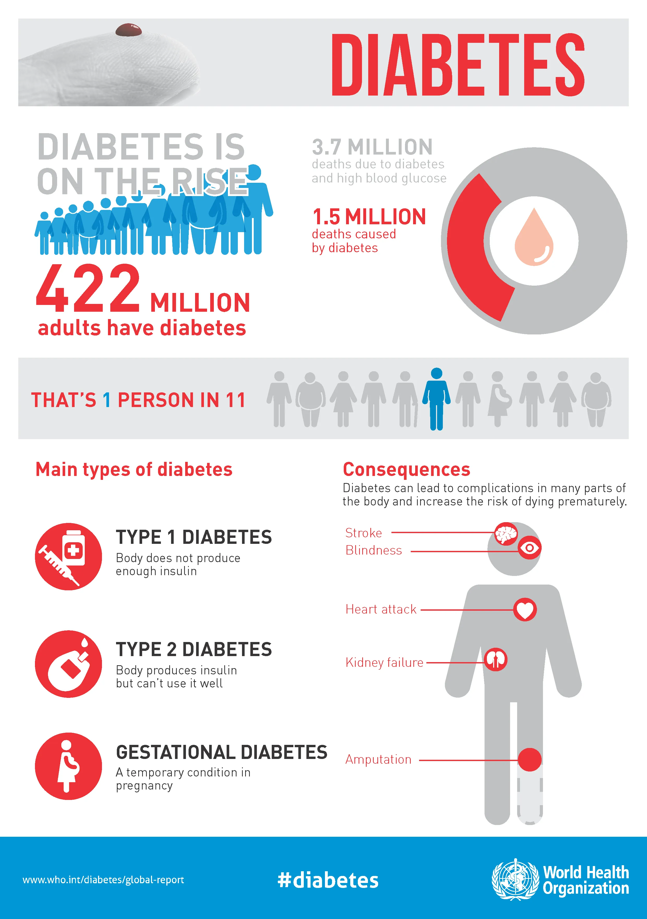 {'en': 'Diabetes will affect 1,300 million people in 2050, twice as much as', 'es': 'La diabetes afectará a 1.300 millones de personas en 2050, el doble que en la actualidad'} Image {'en': 'Diabetes will affect 1,300 million people in 2050, twice as much as', 'es': 'La diabetes afectará a 1.300 millones de personas en 2050, el doble que en la actualidad'} Image