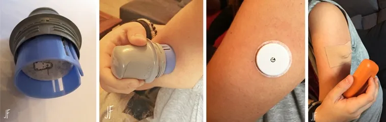 {'en': 'Glucose sensors: this is the reason you should not use them if you do not have diabetes', 'es': 'Sensores de glucosa: esta es la razón por la que no debes utilizarlos si no tienes diabetes'} Image {'en': 'Glucose sensors: this is the reason you should not use them if you do not have diabetes', 'es': 'Sensores de glucosa: esta es la razón por la que no debes utilizarlos si no tienes diabetes'} Image