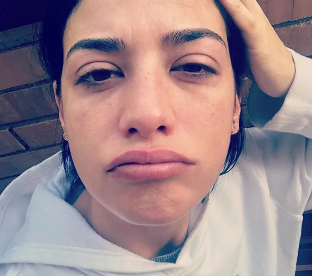 {'en': 'Ares Teixidó, 1 year after the type 1 diabetes diagnosis', 'es': 'Ares Teixidó, 1 año después del diagnostico de diabetes tipo 1'} Image {'en': 'Ares Teixidó, 1 year after the type 1 diabetes diagnosis', 'es': 'Ares Teixidó, 1 año después del diagnostico de diabetes tipo 1'} Image