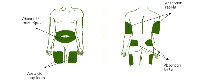 {'en': 'Where insulin should be injected', 'es': 'Donde se debe inyectar la insulina'} Image {'en': 'Where insulin should be injected', 'es': 'Donde se debe inyectar la insulina'} Image