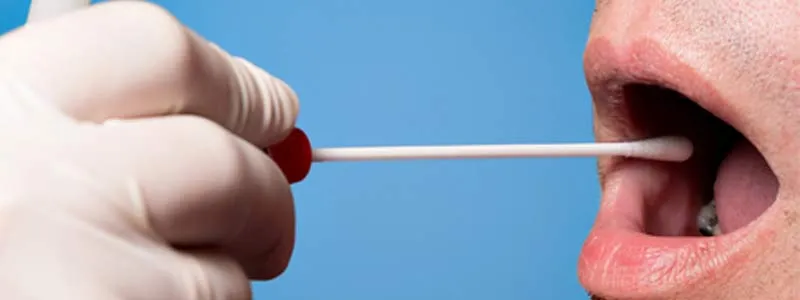 {'en': 'CIATEJ develops early diagnostic test of tuberculosis in people with diabetes', 'es': 'Ciatej desarrolla prueba de diagnóstico temprano de tuberculosis en personas con diabetes'} Image {'en': 'CIATEJ develops early diagnostic test of tuberculosis in people with diabetes', 'es': 'Ciatej desarrolla prueba de diagnóstico temprano de tuberculosis en personas con diabetes'} Image