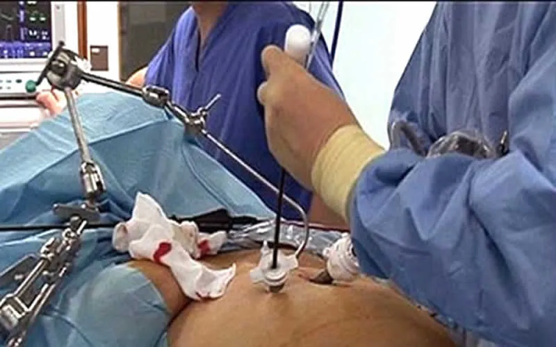 {'en': 'Diabetes: They discover alternative to supply surgery surgeries', 'es': 'Diabetes: Descubren alternativa para suplir cirugías de obesidad mórbida'} Image {'en': 'Diabetes: They discover alternative to supply surgery surgeries', 'es': 'Diabetes: Descubren alternativa para suplir cirugías de obesidad mórbida'} Image