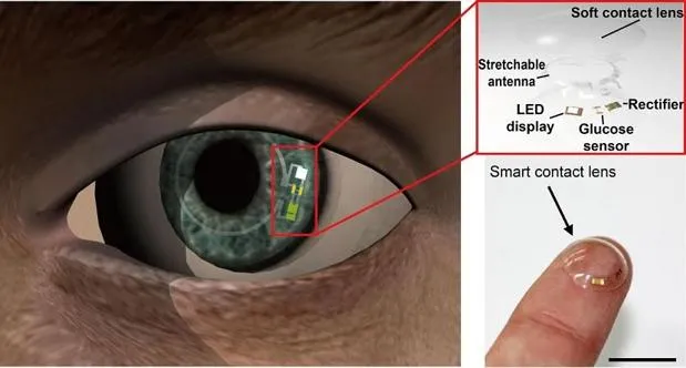 {'en': 'They design a ‘intelligent’ lenses to monitor glucose levels in diabetes', 'es': 'Diseñan una lentilla ‘inteligente’ para monitorizar los niveles de glucosa en la diabetes'} Image {'en': 'They design a ‘intelligent’ lenses to monitor glucose levels in diabetes', 'es': 'Diseñan una lentilla ‘inteligente’ para monitorizar los niveles de glucosa en la diabetes'} Image