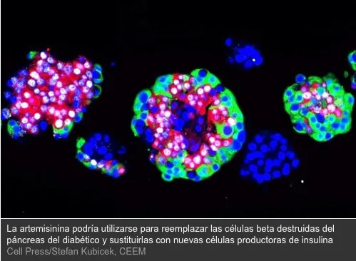 {'en': 'A new drug could cure type 1 diabetes', 'es': 'Un nuevo fármaco podría curar la diabetes tipo 1'} Image {'en': 'A new drug could cure type 1 diabetes', 'es': 'Un nuevo fármaco podría curar la diabetes tipo 1'} Image