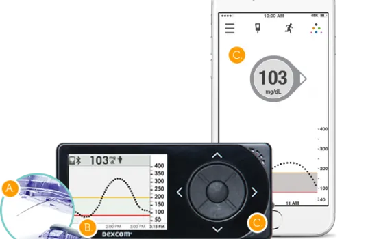 {'en': 'Dexcom G5 Mobile already available on Android', 'es': 'Dexcom G5 Mobile ya disponible en Android'} Image {'en': 'Dexcom G5 Mobile already available on Android', 'es': 'Dexcom G5 Mobile ya disponible en Android'} Image