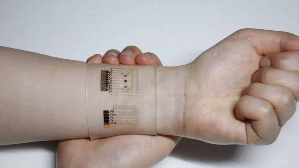 {'en': 'A graphene patch controls diabetes', 'es': 'Un parche de grafeno controla la diabetes'} Image {'en': 'A graphene patch controls diabetes', 'es': 'Un parche de grafeno controla la diabetes'} Image