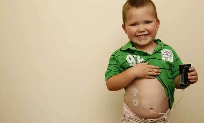 {'en': 'How to use insulin pumps in children and travel?', 'es': 'Cómo usar las bombas de insulina en niños y de viaje?'} Image {'en': 'How to use insulin pumps in children and travel?', 'es': 'Cómo usar las bombas de insulina en niños y de viaje?'} Image