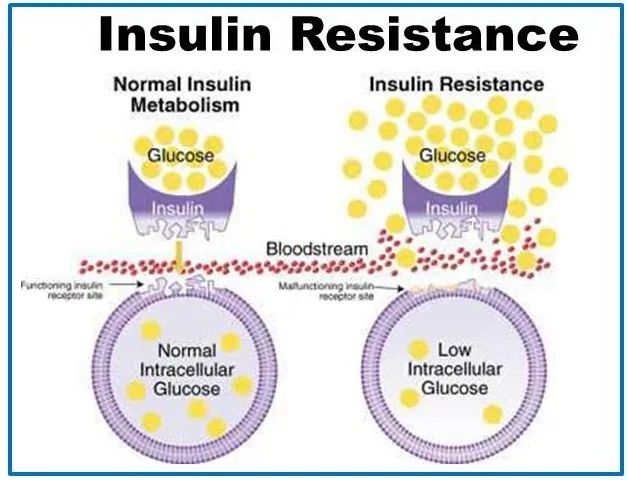 {'en': 'Discovered new insulin resistance mechanism in type 2 diabetes', 'es': 'Descubierto nuevo mecanismo de resistencia a la insulina en la diabetes tipo 2'} Image {'en': 'Discovered new insulin resistance mechanism in type 2 diabetes', 'es': 'Descubierto nuevo mecanismo de resistencia a la insulina en la diabetes tipo 2'} Image